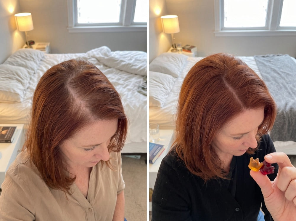 Joanne P., 54, before and after