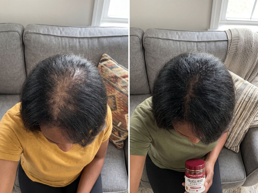Elaine R., 51, before and after