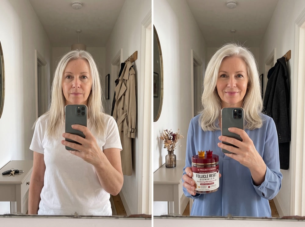Cathy W., 57, before and after
