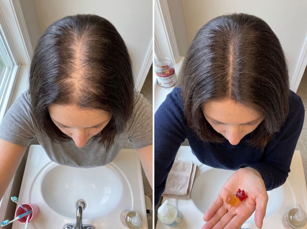 Diane K., 52, before and after